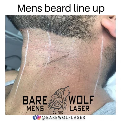 Bare Wolf Mens Laser Clinic, Brampton - 
