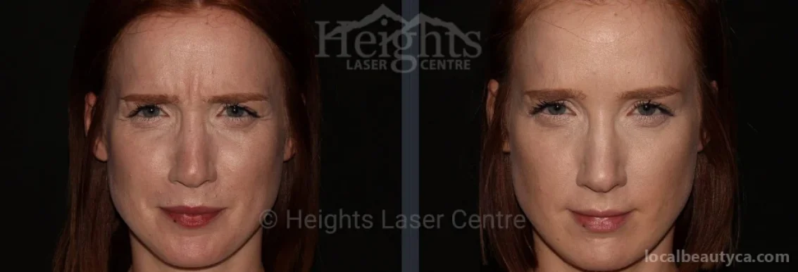 Heights Laser Centre, Burnaby - Photo 8