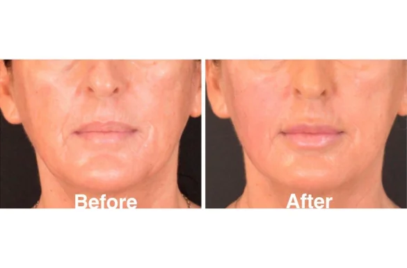 Dr. Kristina Zakhary - Rhinoplasty & Facial Plastic Surgery Clinic, Calgary - Photo 3