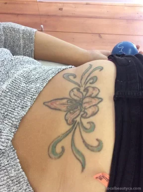 NUYU Laser Tattoo Removal, Montreal - Photo 2