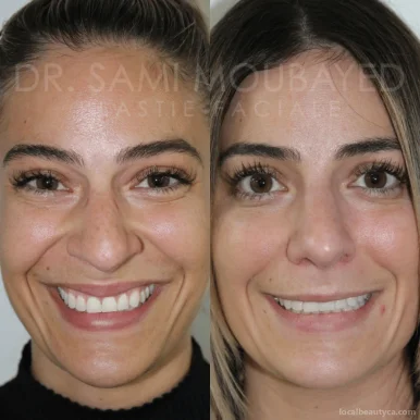 Clinique Face Md | Botox Montréal, Quebec - Photo 2
