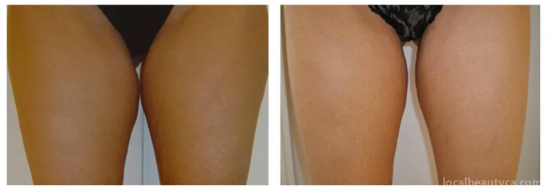 Royal Laser & Skincare Clinic - Laser Hair Removal, Richmond Hill - Photo 4