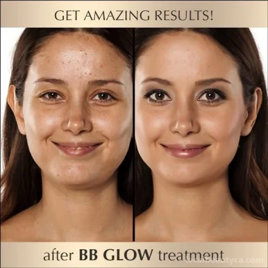 Awesome Beauty Laser and skin care, Surrey - Photo 3