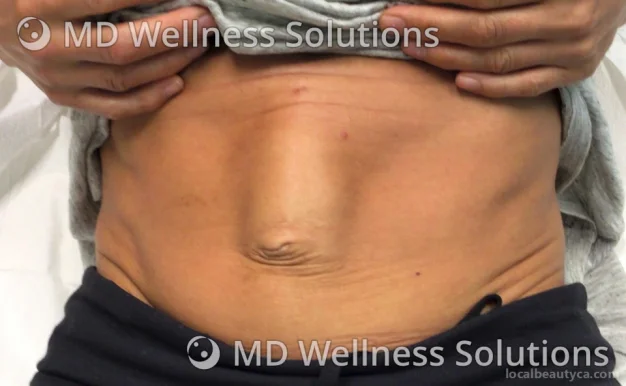 MD Wellness Solutions, Surrey - Photo 6