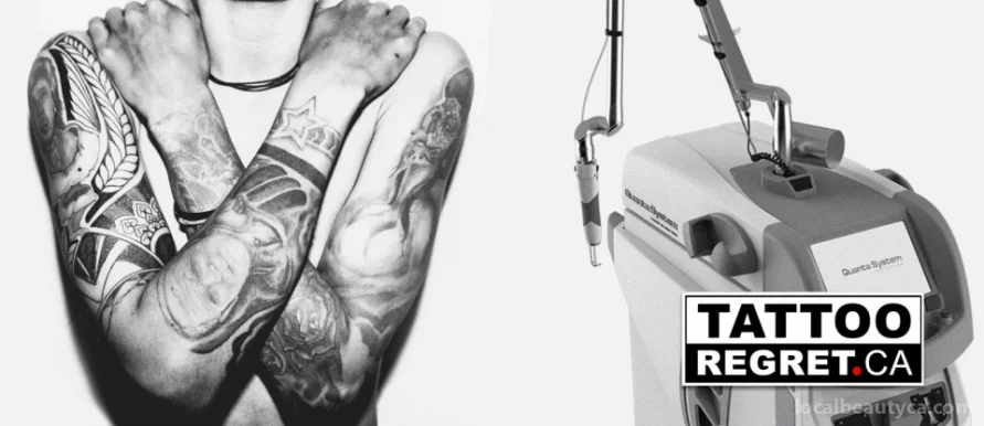 Tattoo Regret | Laser Tattoo Removal Toronto, Toronto - Photo 2