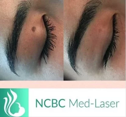 NCBC Med-Laser, Toronto - Photo 3