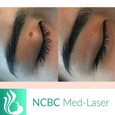 NCBC Med-Laser, Toronto - Photo 1