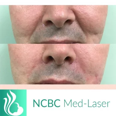 NCBC Med-Laser, Toronto - Photo 3
