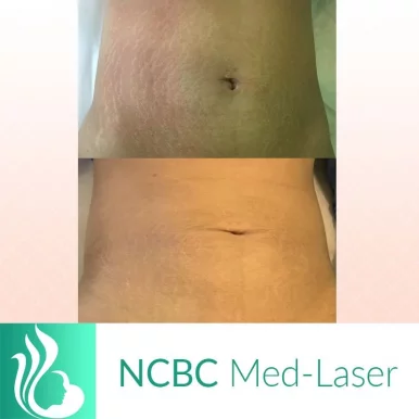 NCBC Med-Laser, Toronto - Photo 2