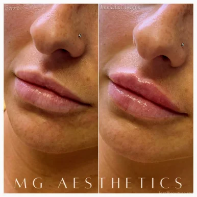MG AESTHETICS - Botox | Dysport | Fillers | Morpheus8 | Microneedling, Vaughan - Photo 1