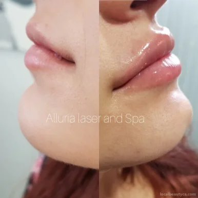 Alluria laser and med Spa, Vaughan - Photo 4